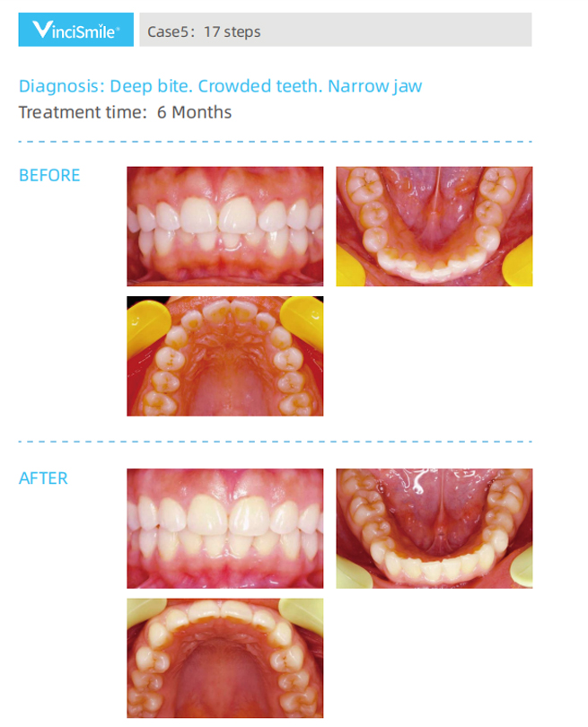 Vincismile Software System Clinical Application